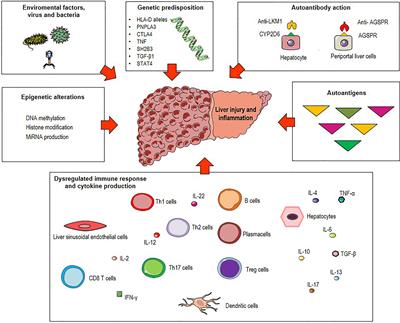 Impact of Antigen Presentation Mechanisms on Immune Response in Autoimmune Hepatitis